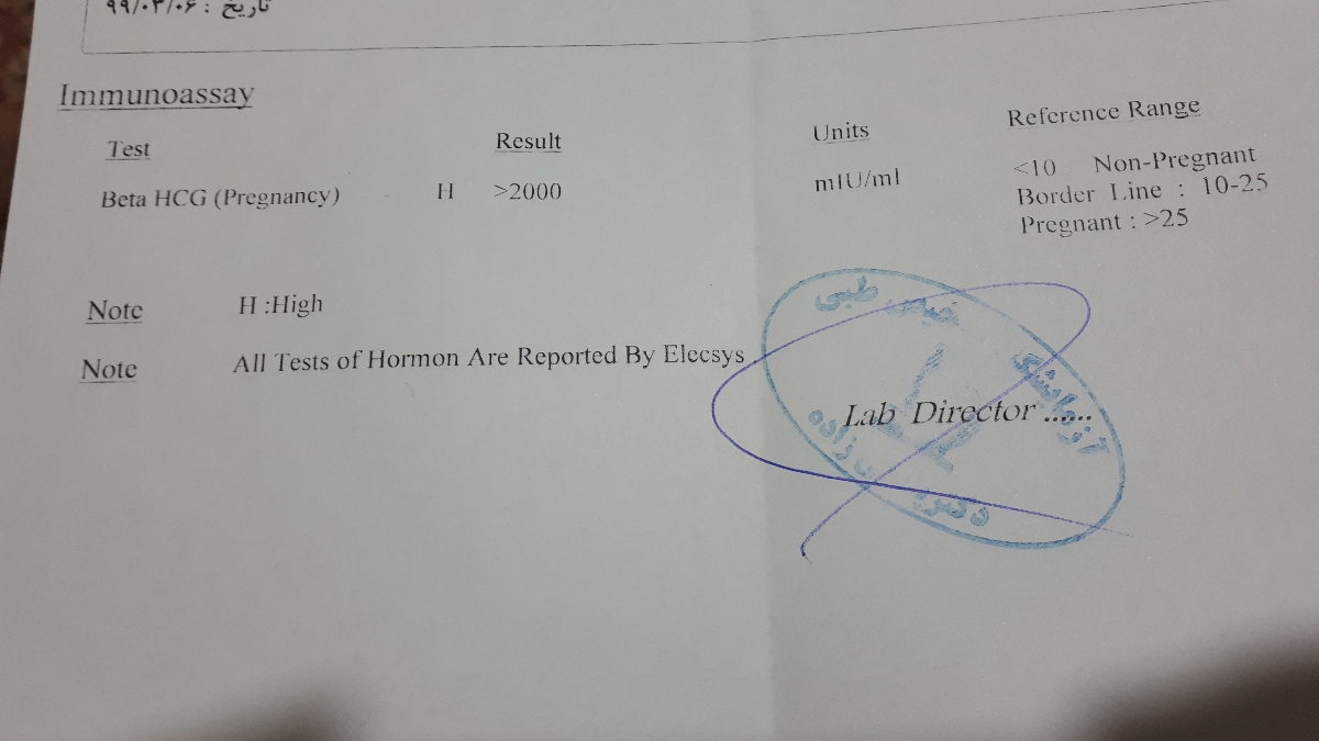جواب آزمایش بتا