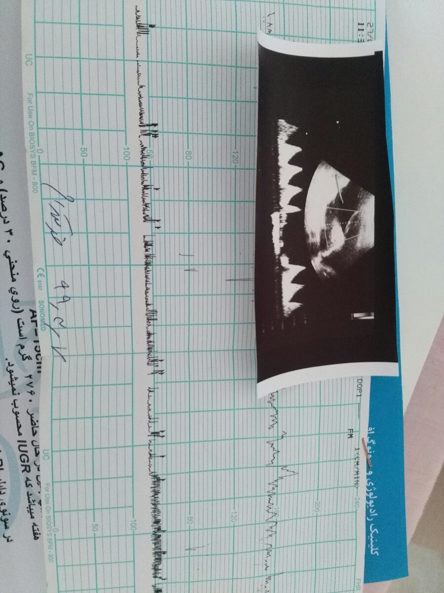 سونو کالر داپلر هفته 36