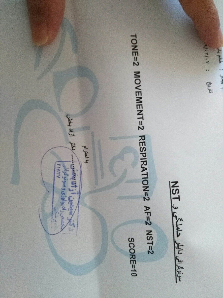 سونو کالر داپلر هفته 36