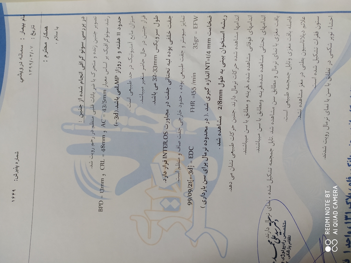 سونوی nt غربالگری اول