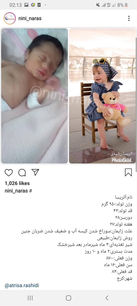 نوزاد از چند هفته زود بدنیا بیاد زنده میمونه😢😢😢