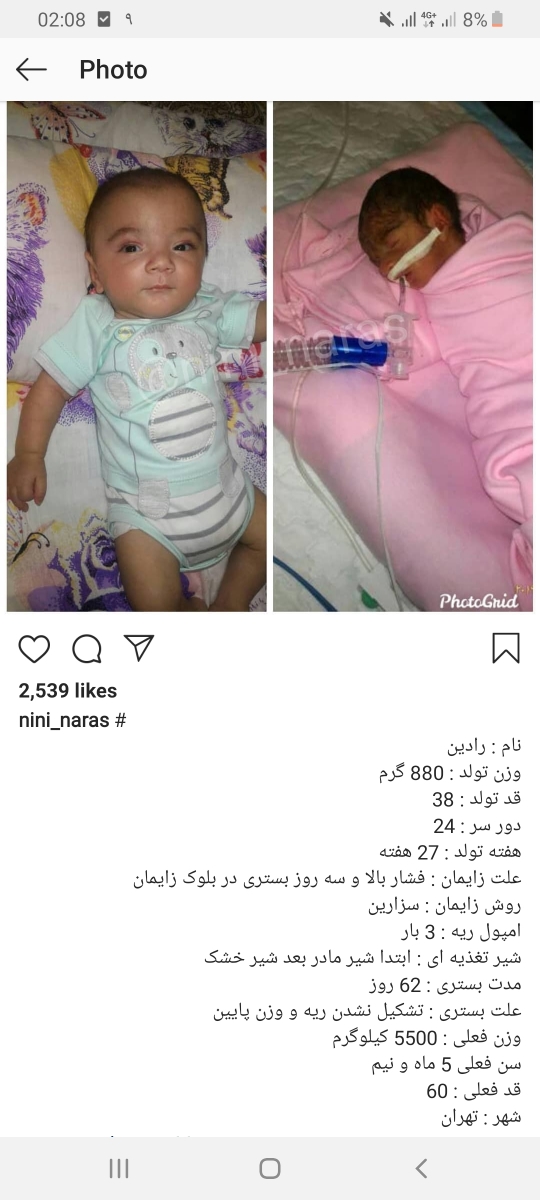 نوزاد از چند هفته زود بدنیا بیاد زنده میمونه😢😢😢