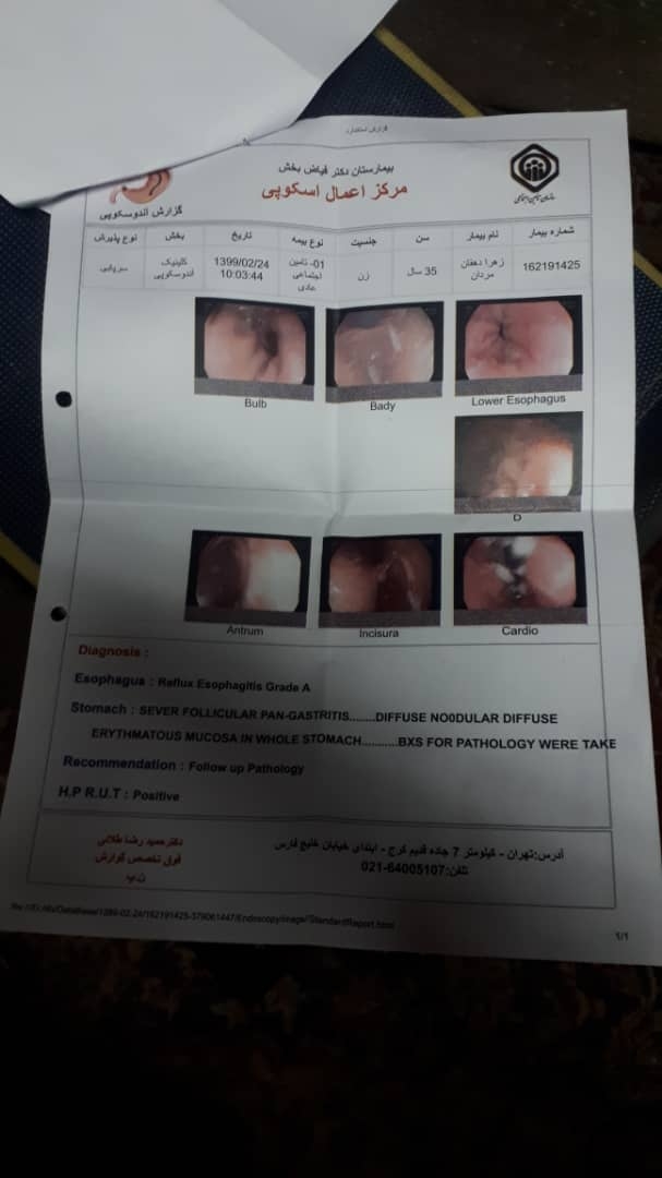 جواب اندوسکوپی از معده جواب اندوسکوپی از معده