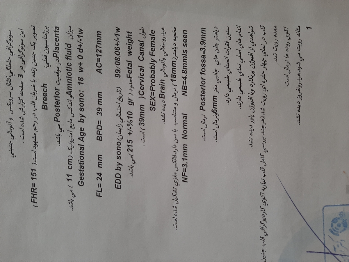 سونو انومالی هفته ۱۸