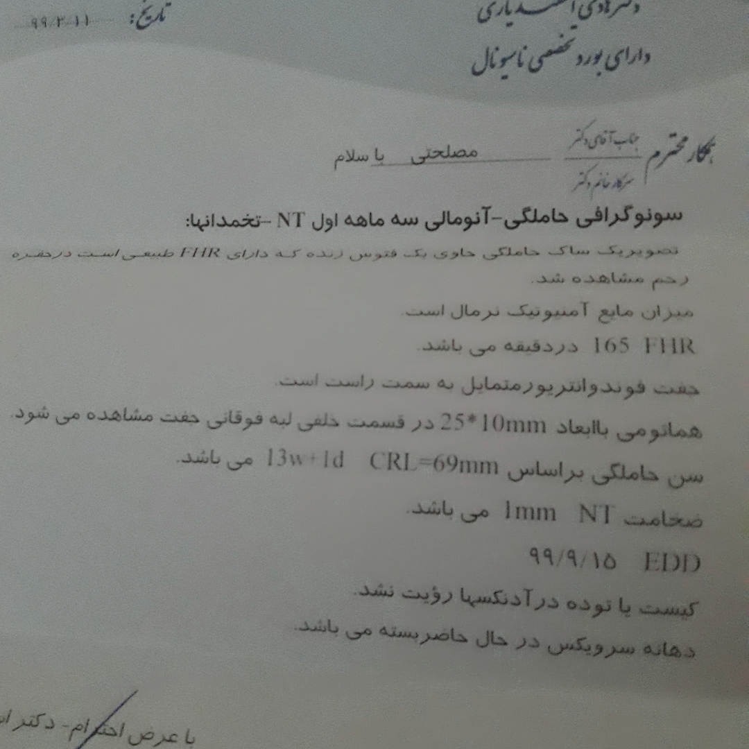 تفسیر سونوی ان تی تفسیر سونوی ان تی