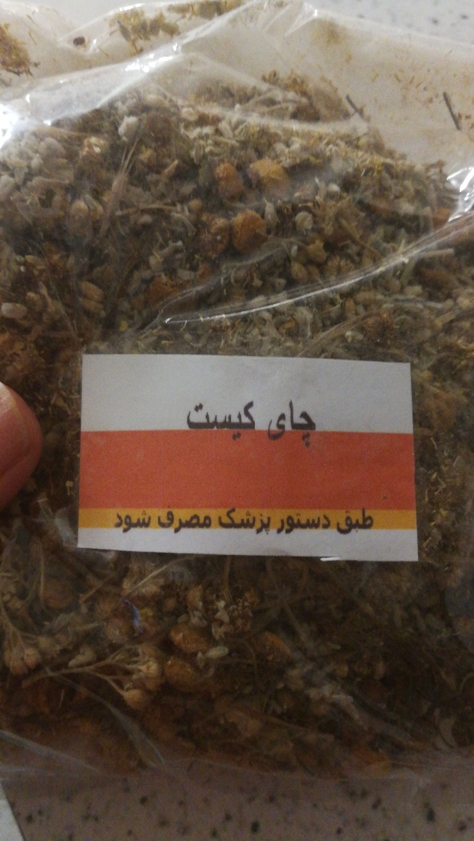 تفسیر سونو گرافی بارداری تفسیر سونو گرافی بارداری