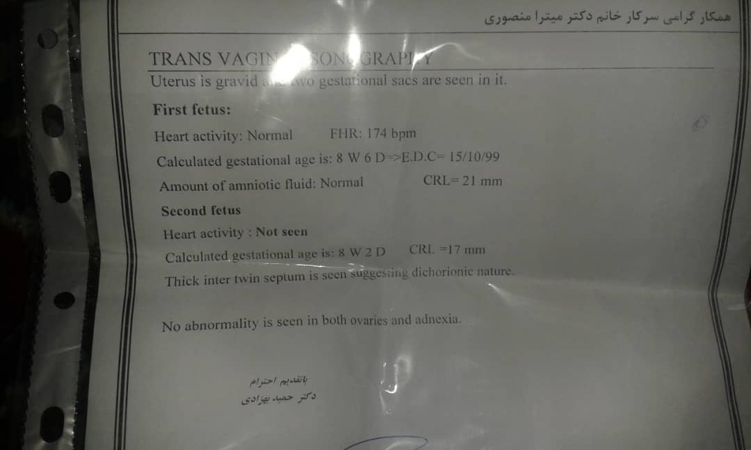 سلام خانوما این سونو رو تفسیرکنید