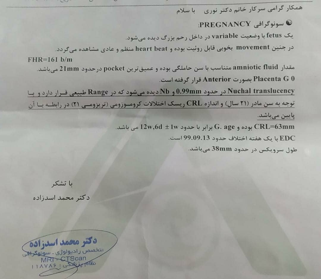 بررسی غربال اول و سونوی ان تی NT