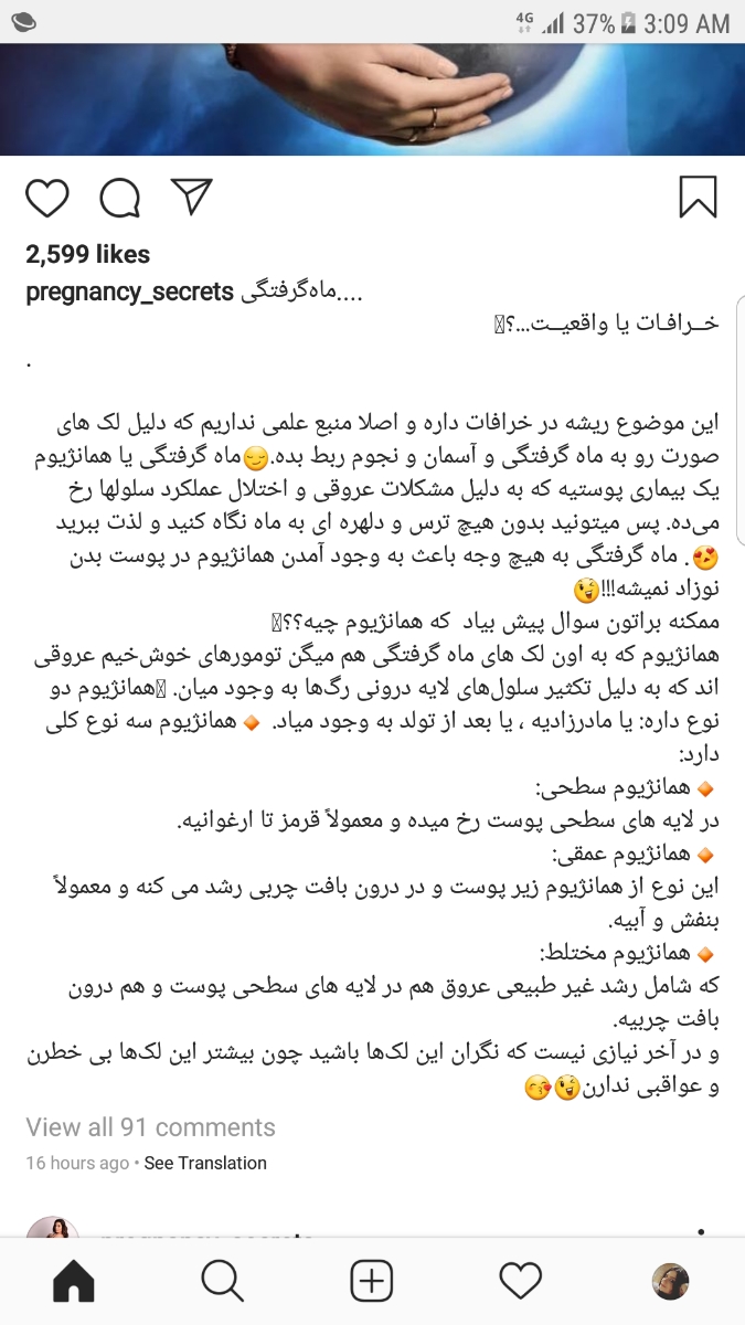 بچه هاااااااااا لطفا بیاین ببینم امشب ماه گرفتگی بووووود؟؟؟؟؟؟؟؟؟