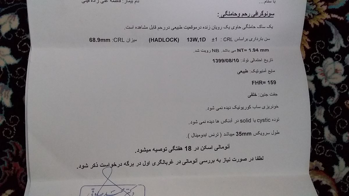سونوی ان تی و ان بی سونوی ان تی و ان بی