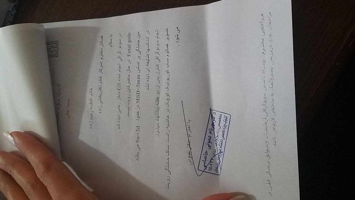خونریزی بدون درد در ۶ هفته خونریزی بدون درد در ۶ هفته