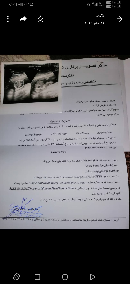 جنسیت ۱۸ هفته جنین جنسیت ۱۸ هفته جنین