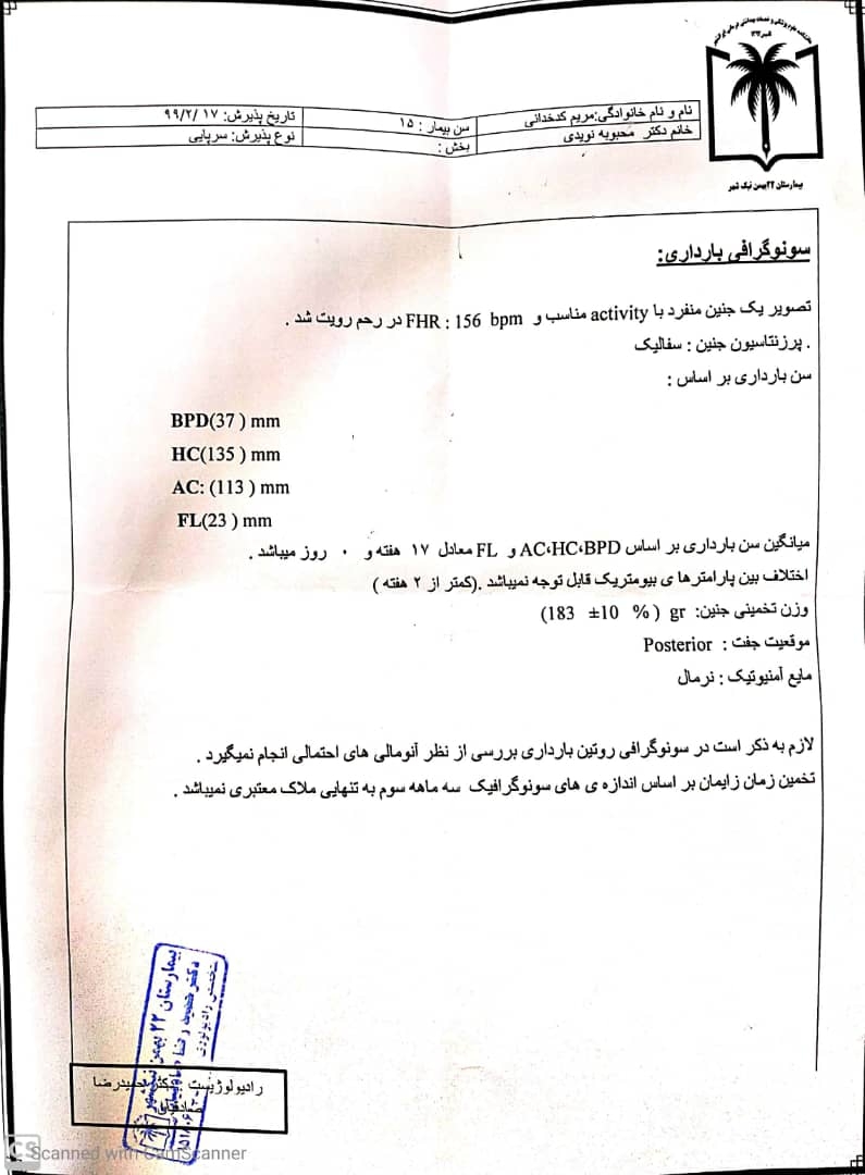 خوردن شیرینیجات زیاد در بارداری خوردن شیرینیجات زیاد در بارداری