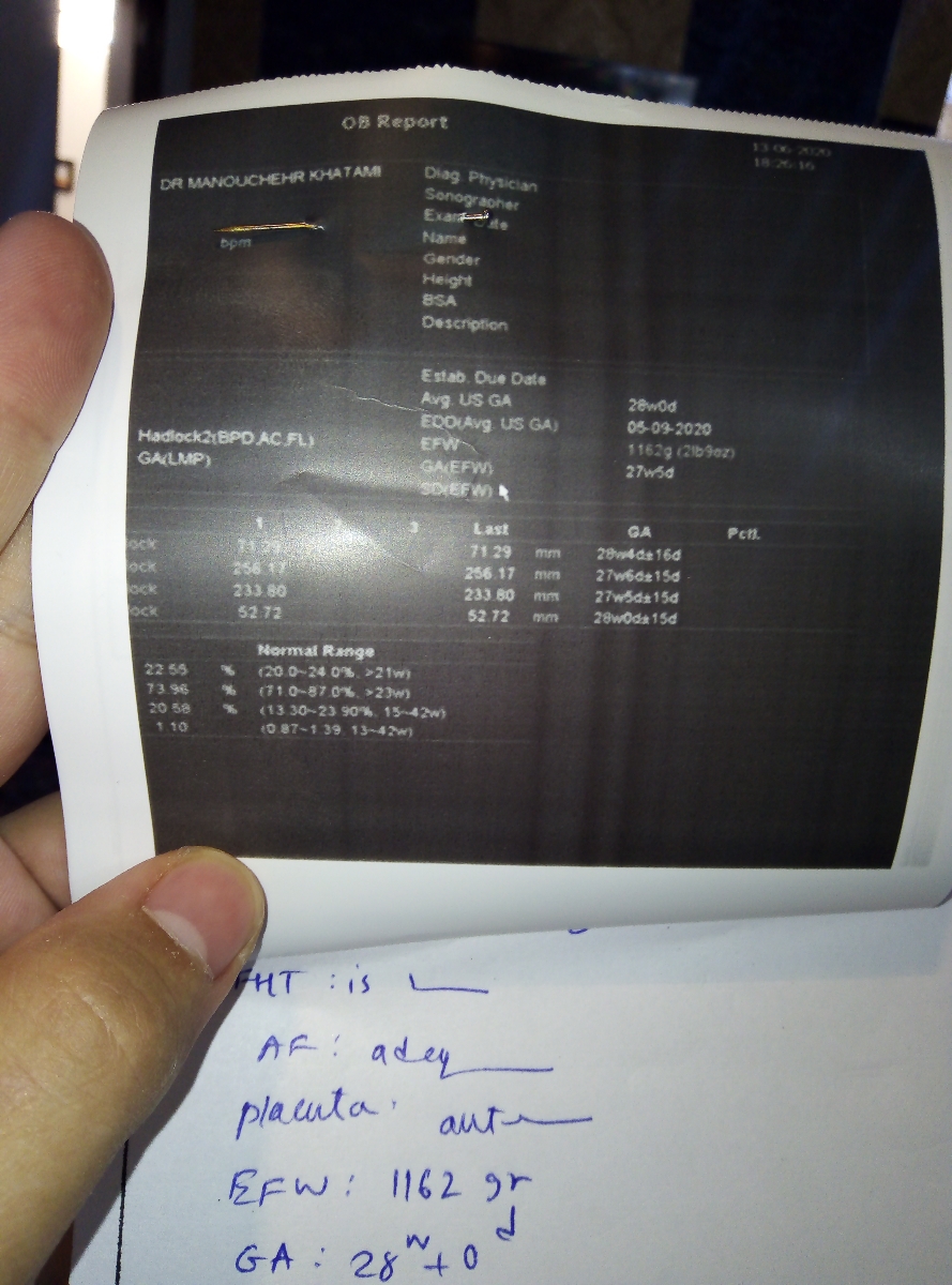 دوستان اگه میشه یه نگاهی به سونو من بندازین..ممنون‌❤😊