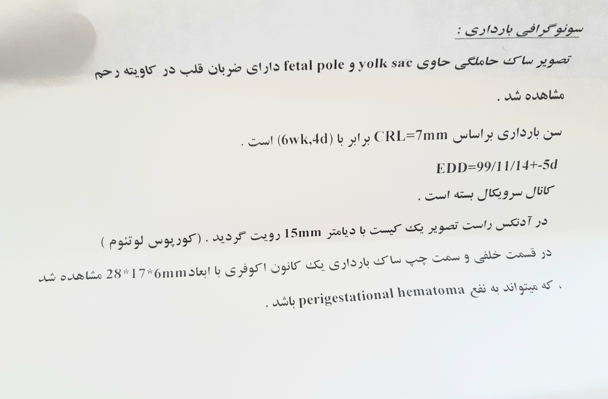 سقط ۶ هفته و لخته خون سقط ۶ هفته و لخته خون