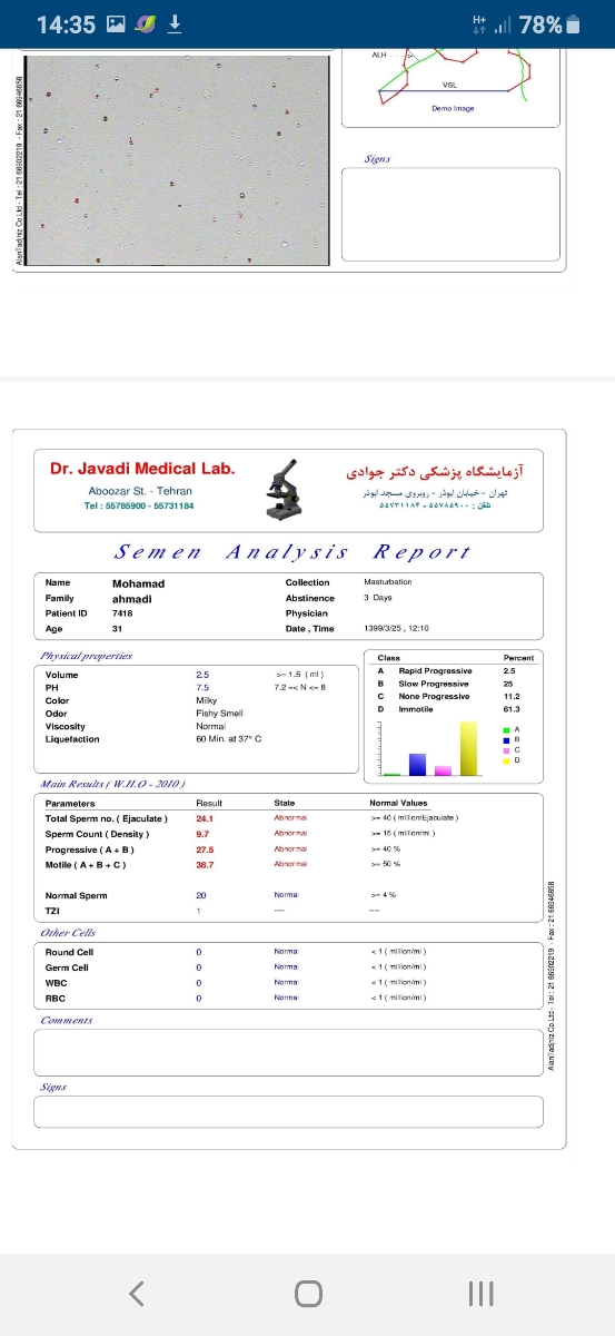 تفسیر آزمایش اسپرم همسر
