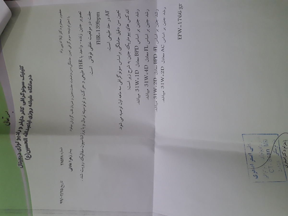 تشخیص اشتباه در سونو تشخیص اشتباه در سونو
