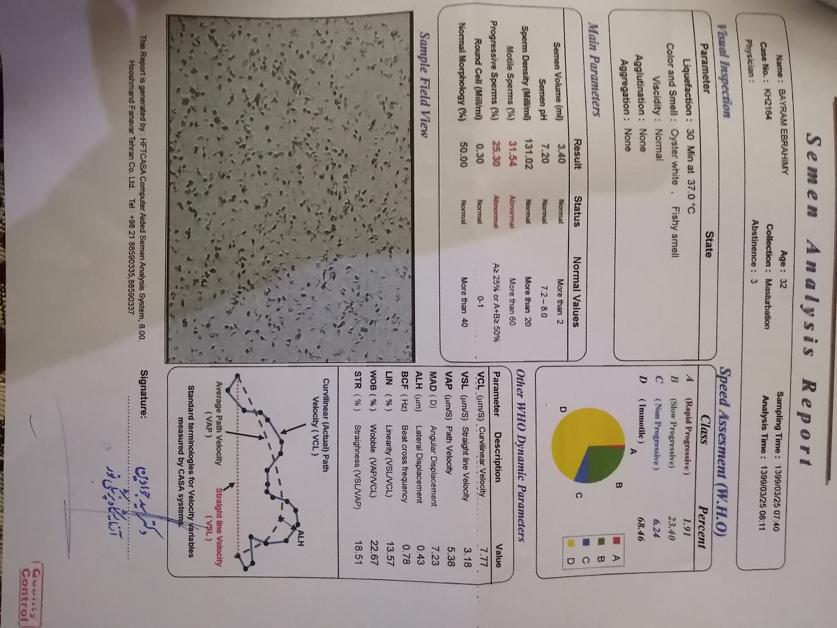 تفسیر ازمایش اسپرم همسرم