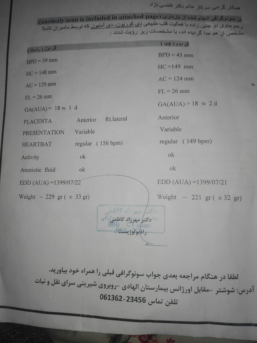 لگد زدن دوقلو ها در واژن