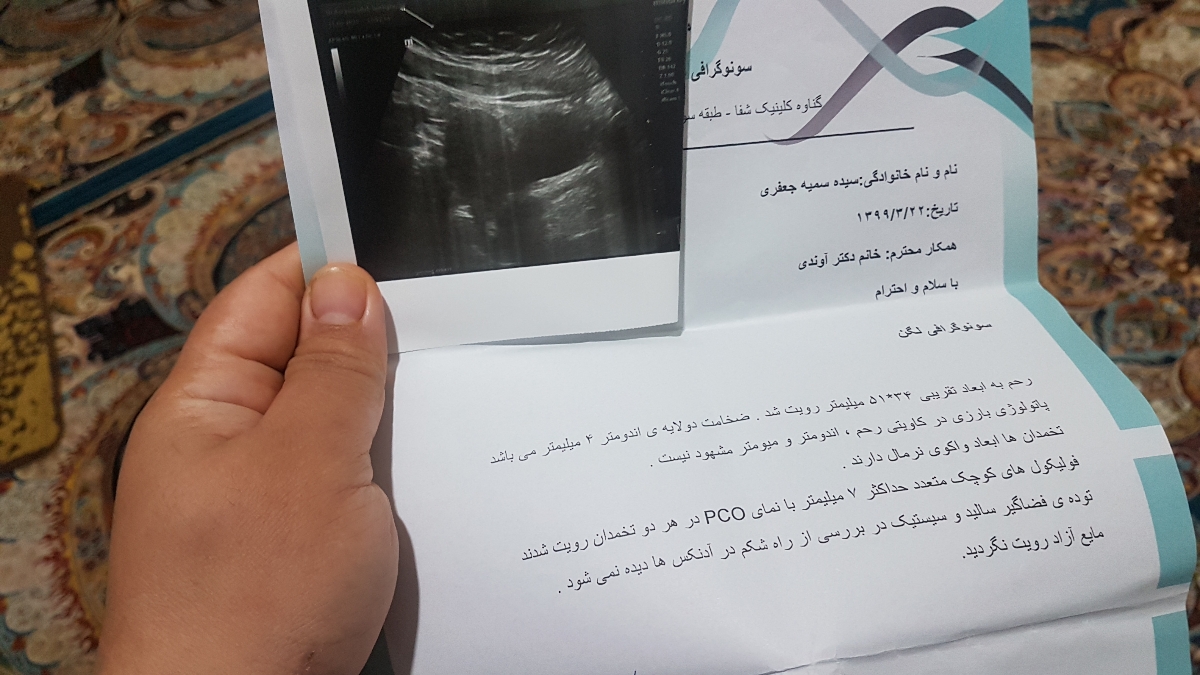 بی بی چک منفی و مثبت کاذب