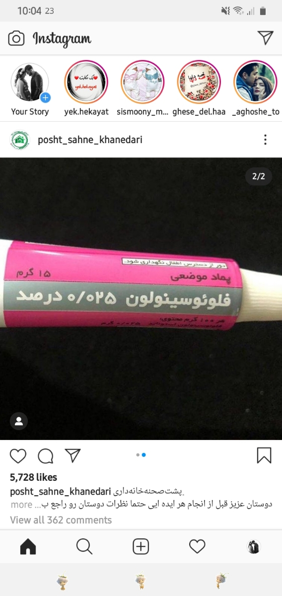 اگزمای پوست دست به چه علتی ممکنه باشه اگزمای پوست دست به چه علتی ممکنه باشه