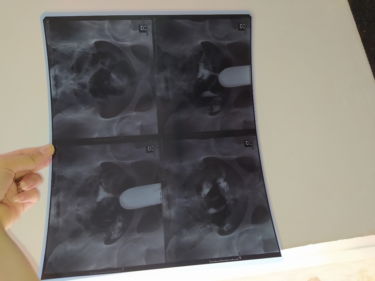 سلام عکس رنگی گرفتم میشه ببینید