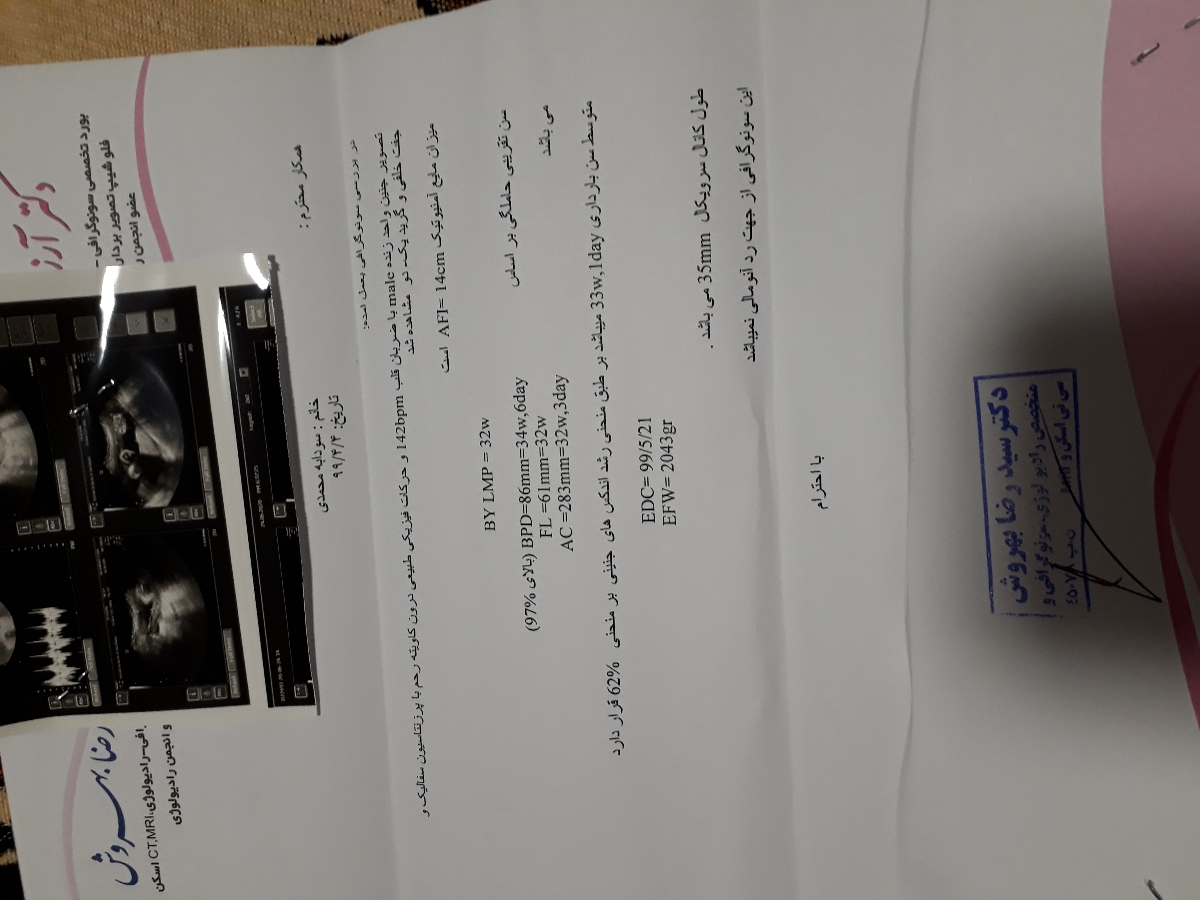 جواب سونو قد وزن