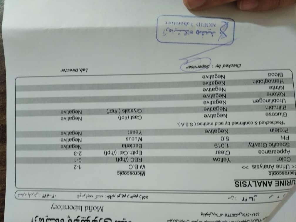 آزمایش منتظر جوابم آزمایش منتظر جوابم