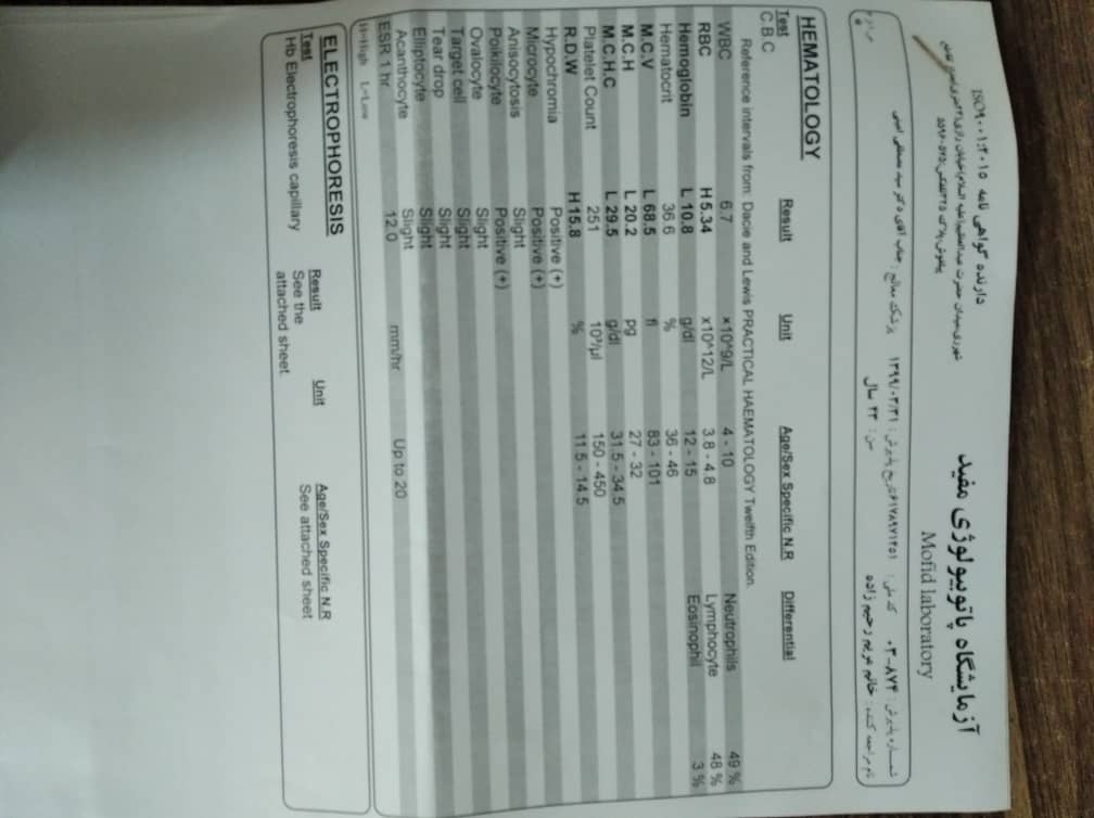 آزمایش منتظر جوابم آزمایش منتظر جوابم