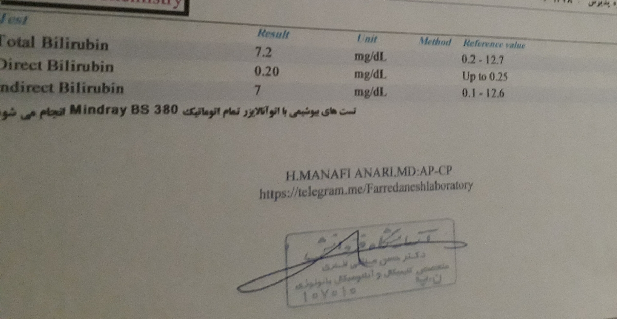 تفسیر ازمایش زردی نوزاد