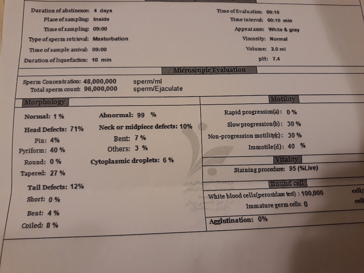 تفسیر سونوی واریکوسل و بیضه و ازمایش اسپرم