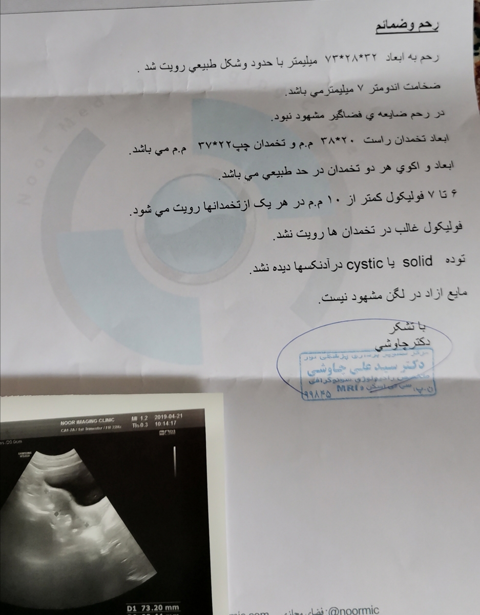 جواب سونو ایا تنبلی تخمدان دارم