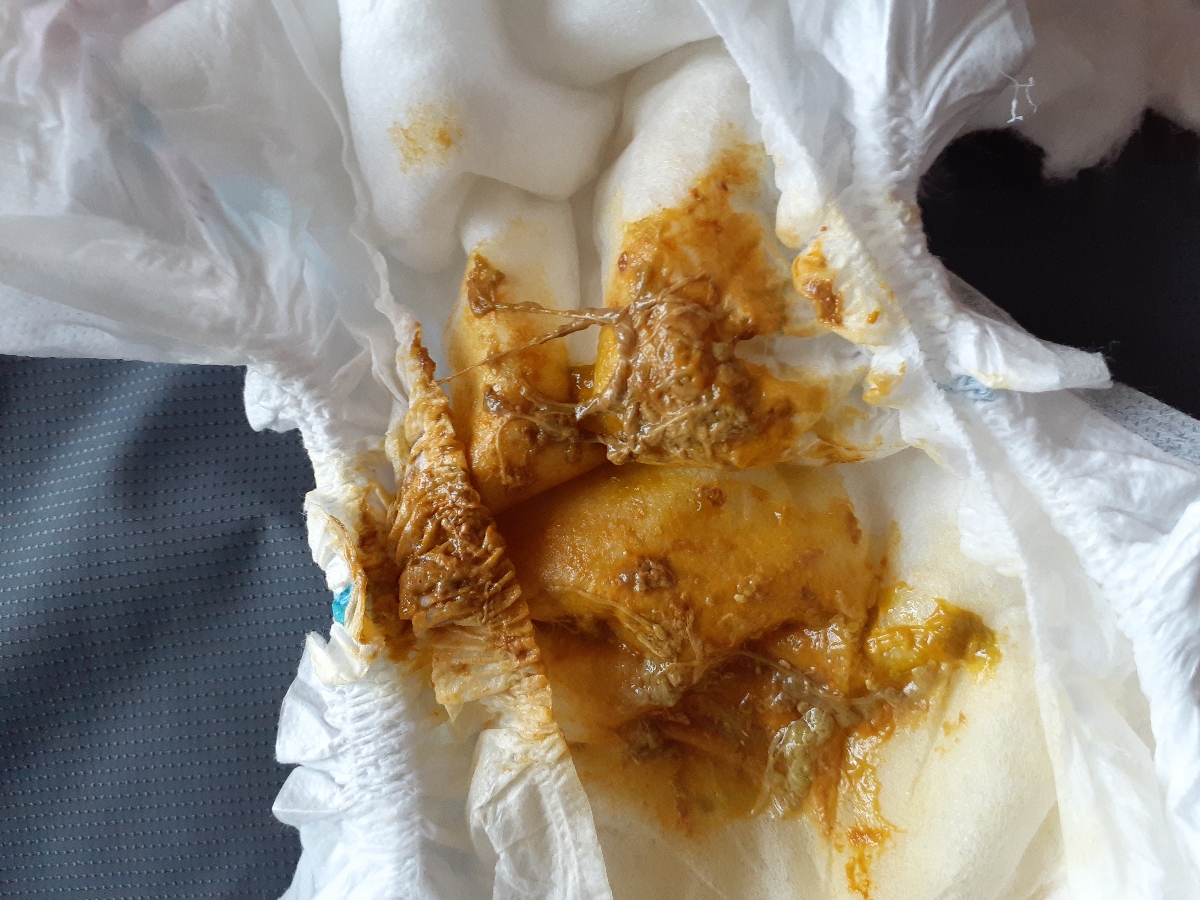 مدفوع نوزاد ۲ماه ونیم(عکس)