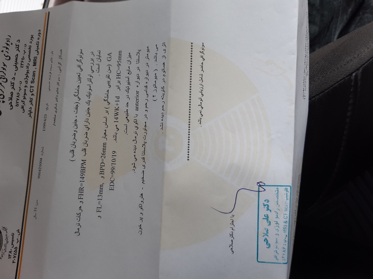 میوماتوز در بارداری چیست