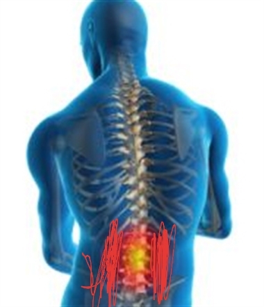 کمر درد شدید دارم