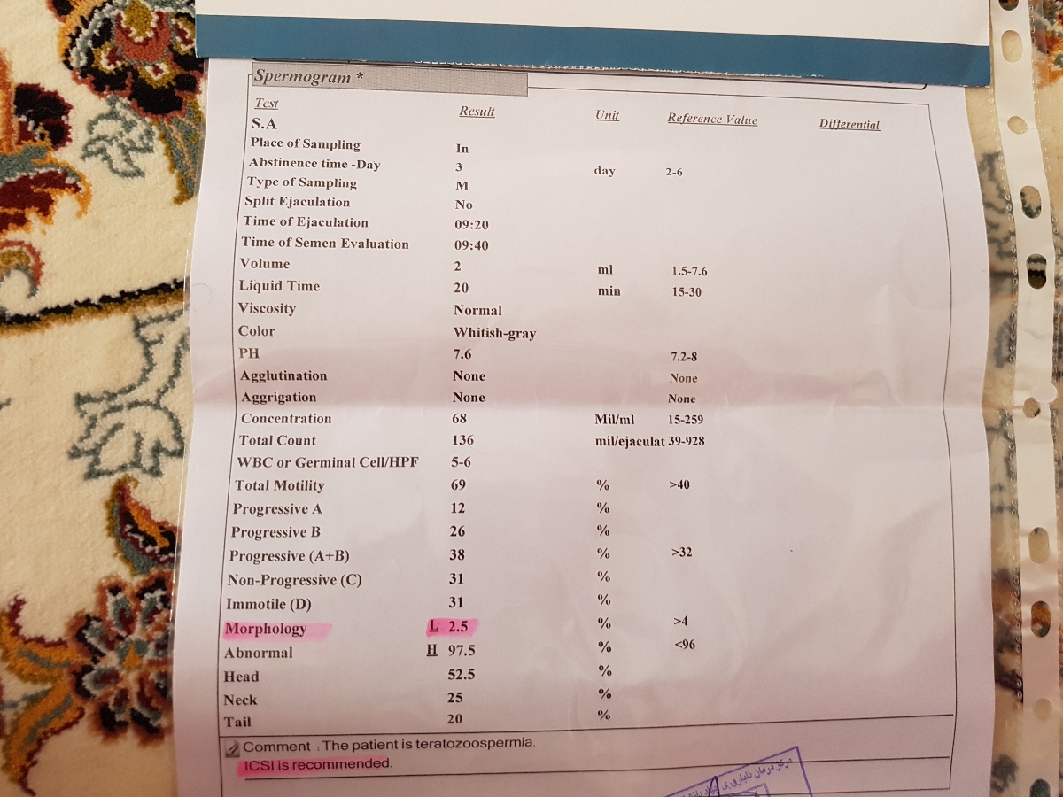 هزینه میکروانجکشن چقدره ؟