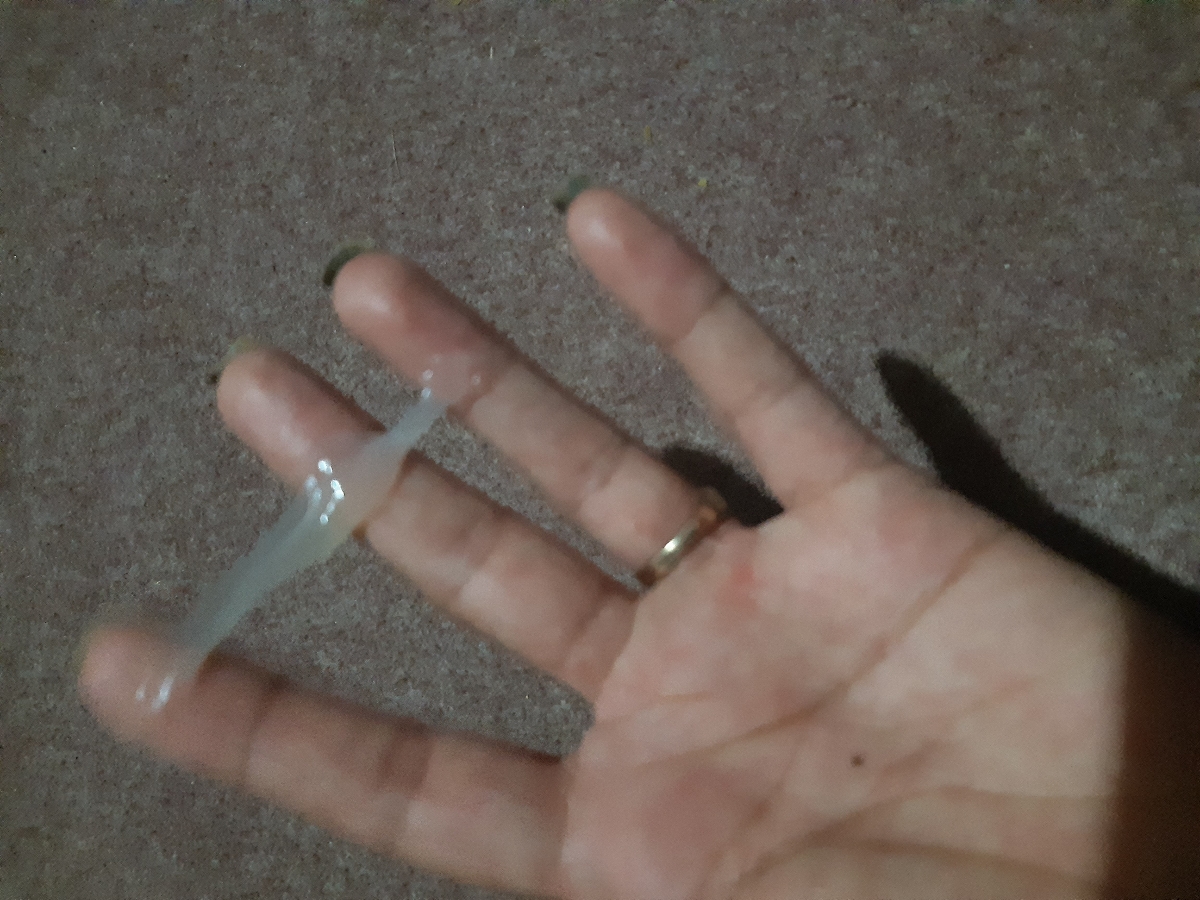 اقدام به بارداری ،درد پهلو سمت چپ