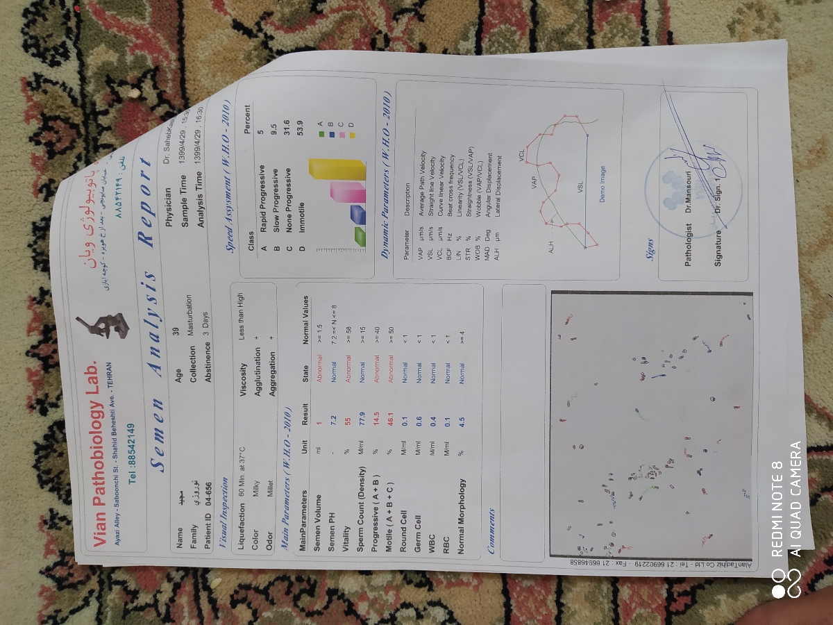 اسپرموگرام و کم تحرکی اسپرم