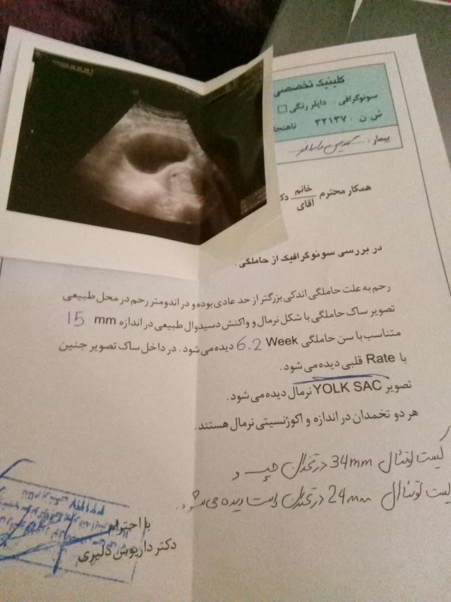لک بینی در هفته ۶ بارداری