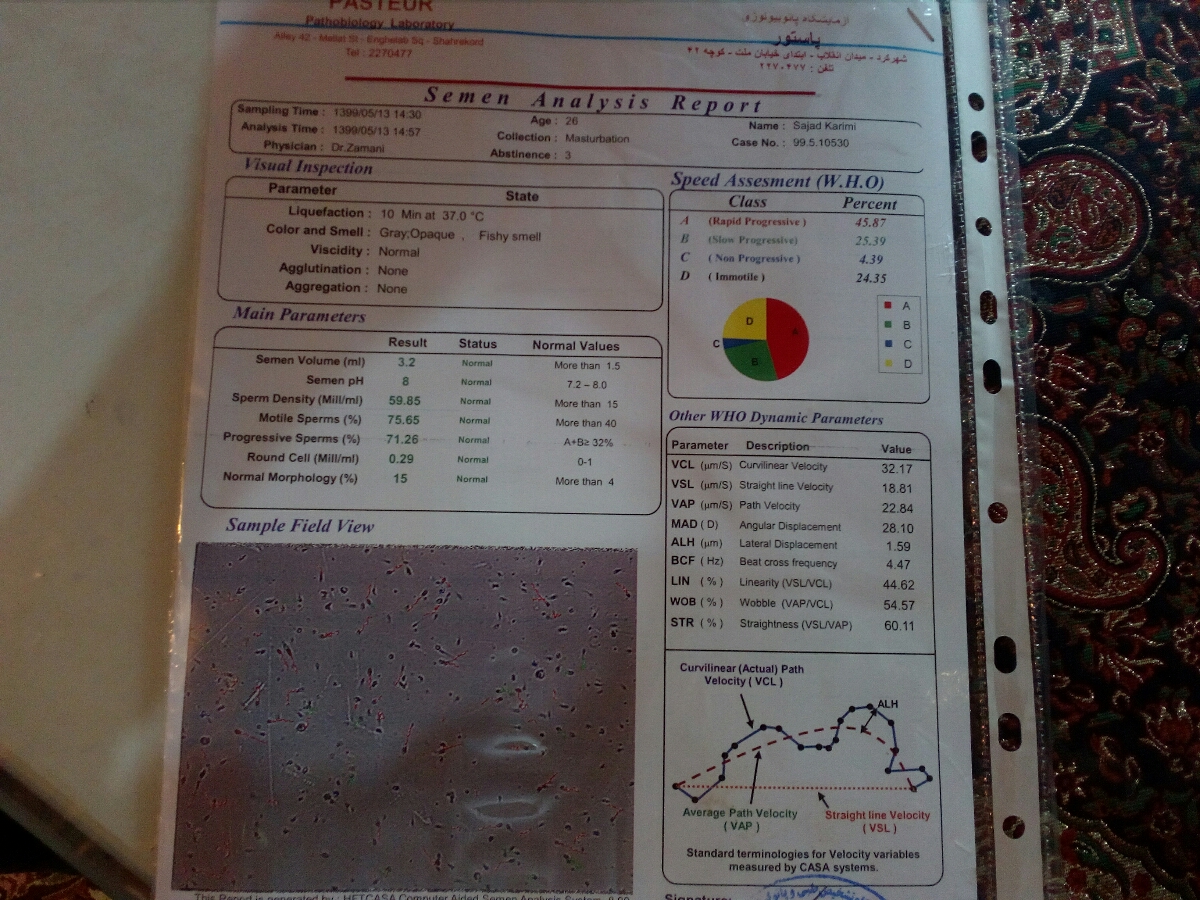 تفسیر ازمایش اسپرم همسرم