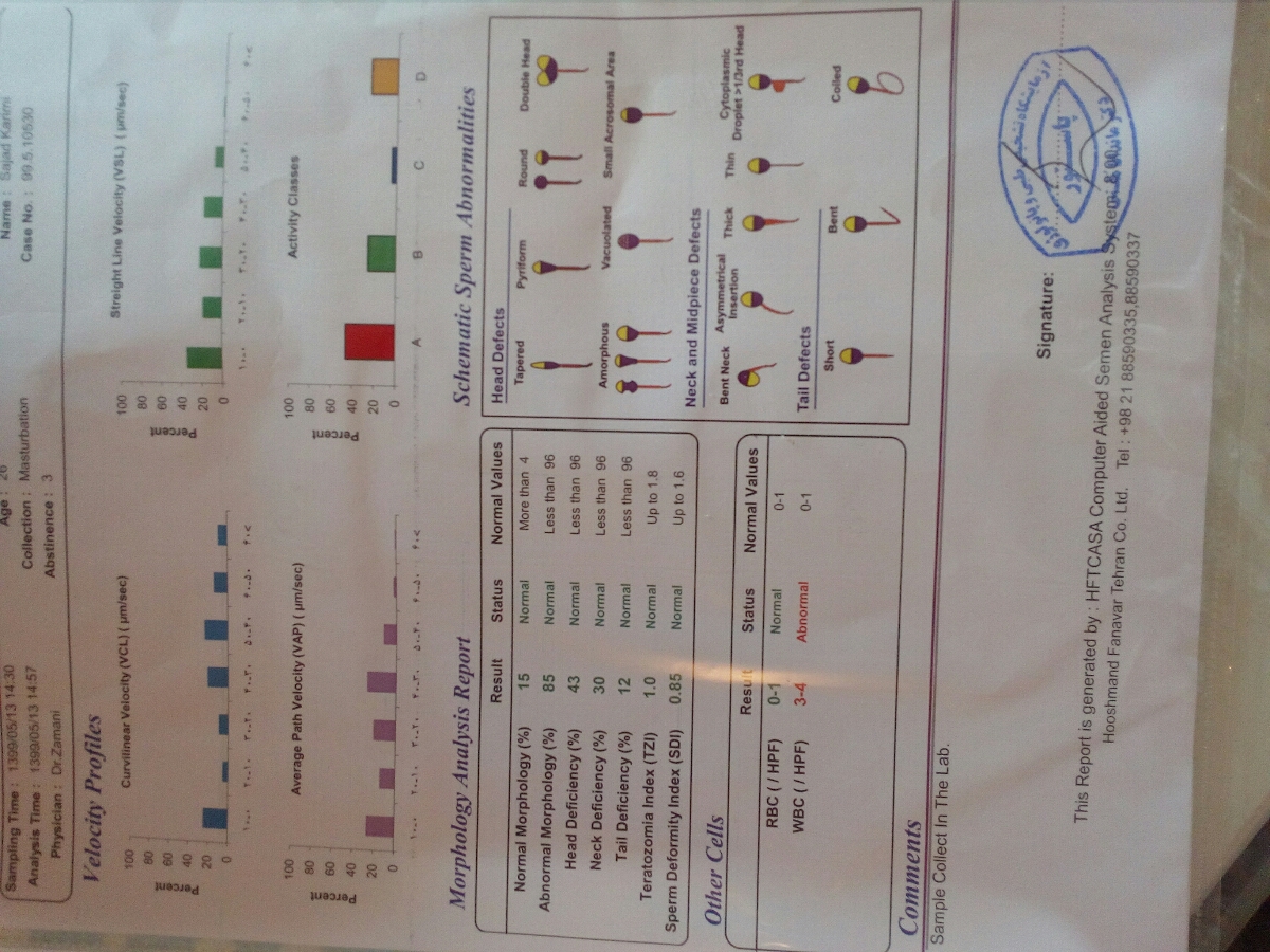 تفسیر ازمایش اسپرم همسرم
