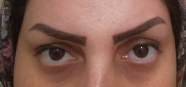 تشخیص بارداری از حالت چشم ها تشخیص بارداری از حالت چشم ها