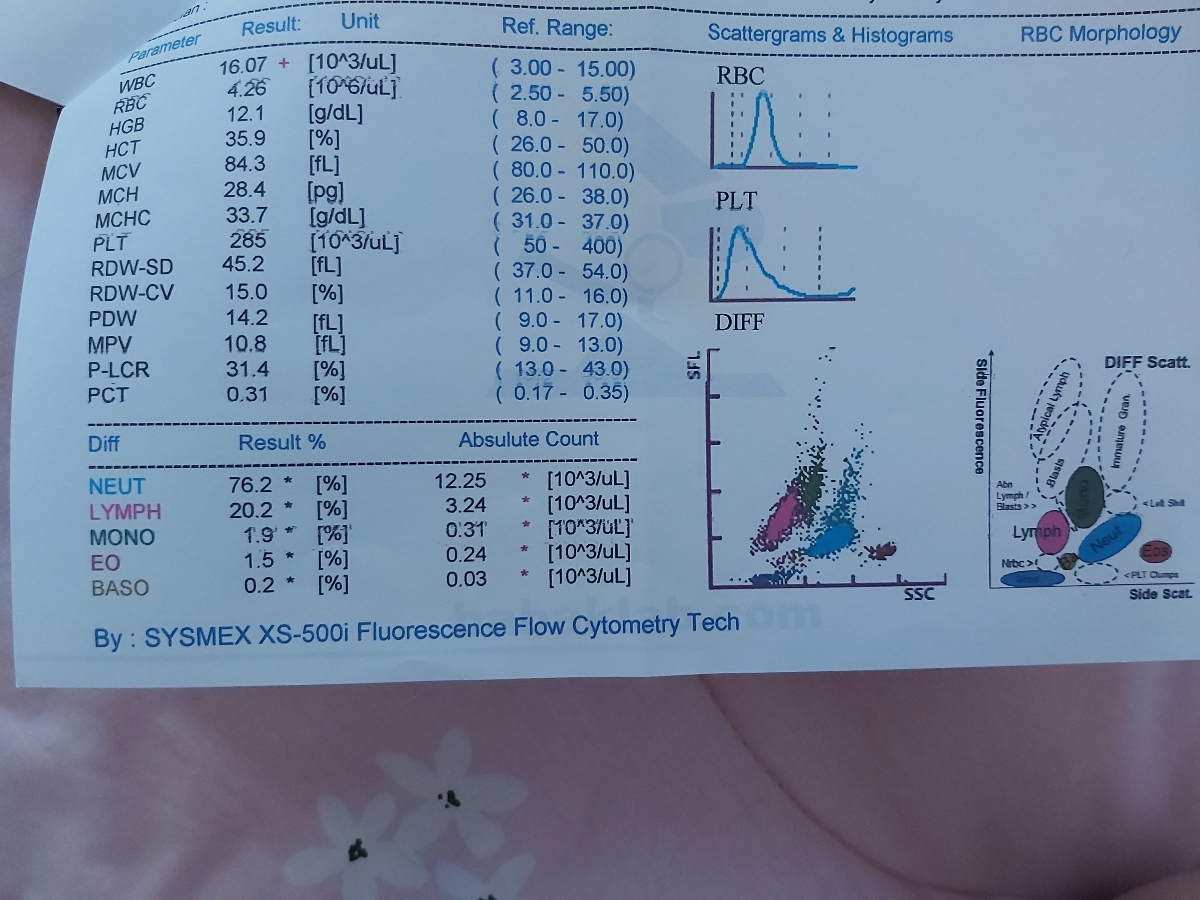 🔴🔴🔴تفسیر جواب آزمایش خون ..میشه تفسیرش کنید دوستان؟؟؟🔴🔴🔴