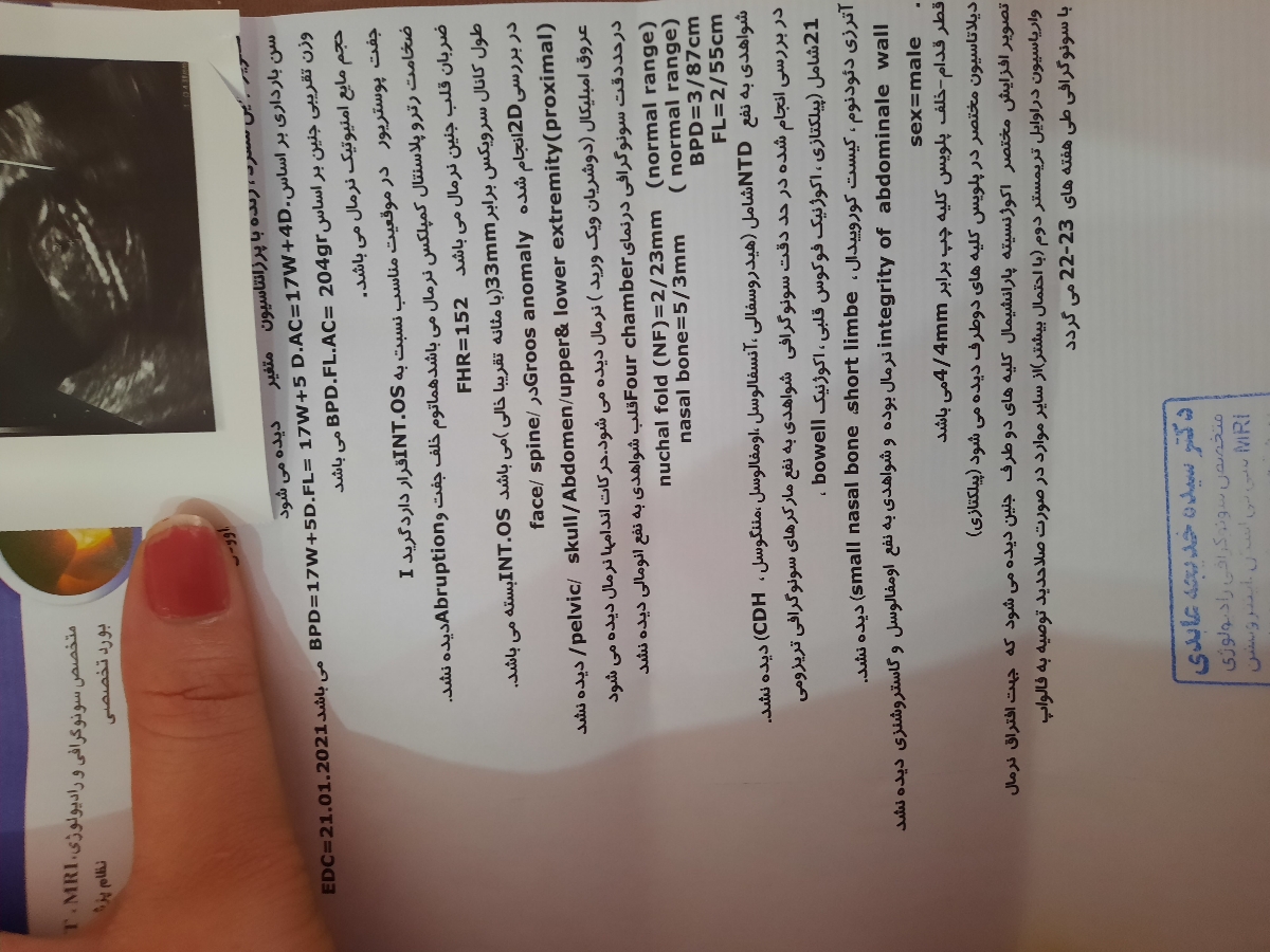 بچه‌ها بیاید غربالگری من و ببینید