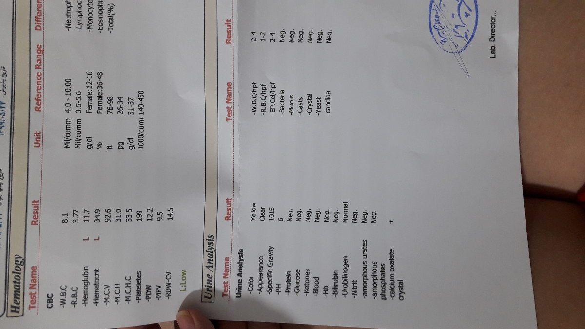 آزمایش منو ببین لطفا