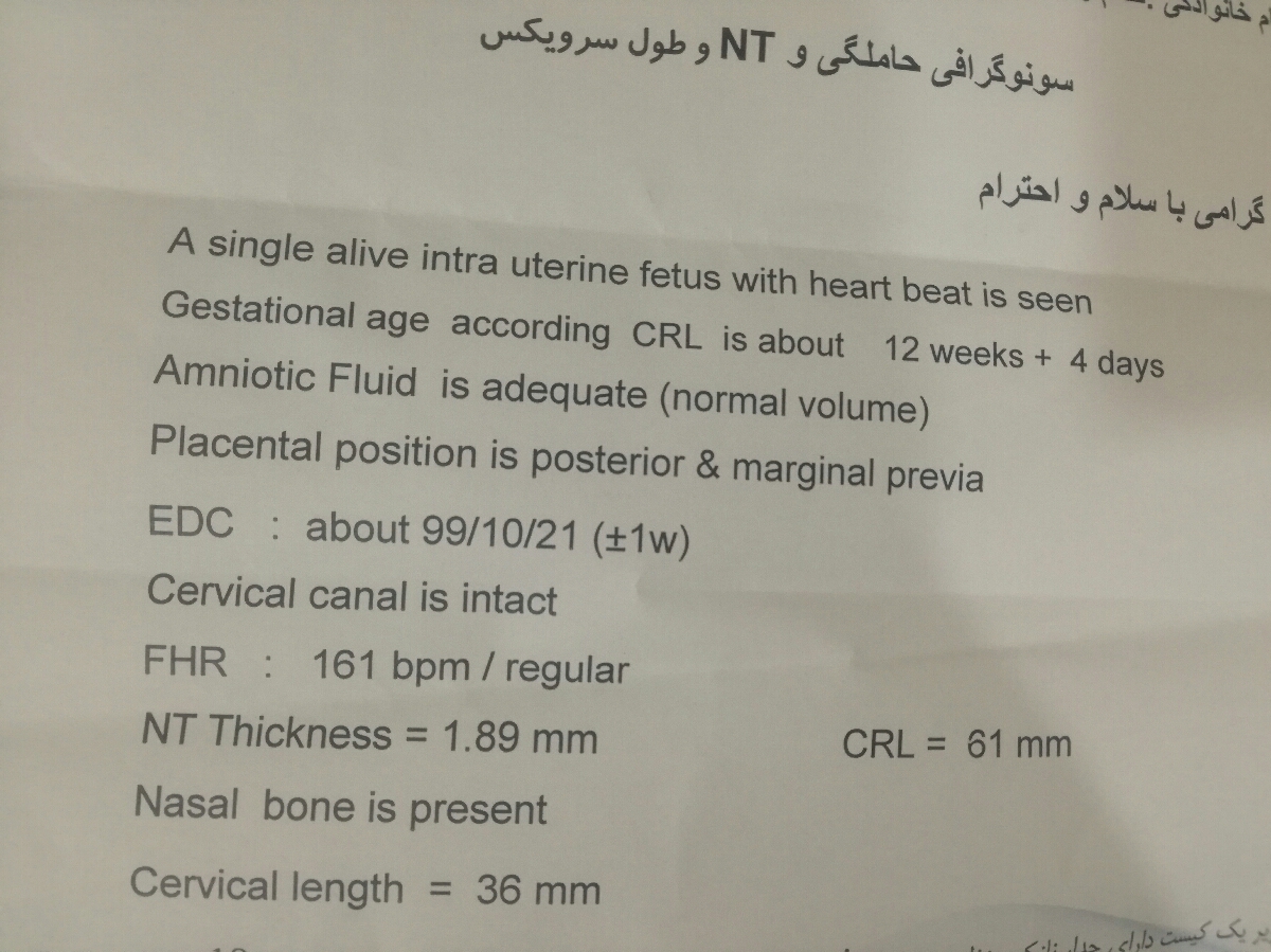 سونو انومالی .