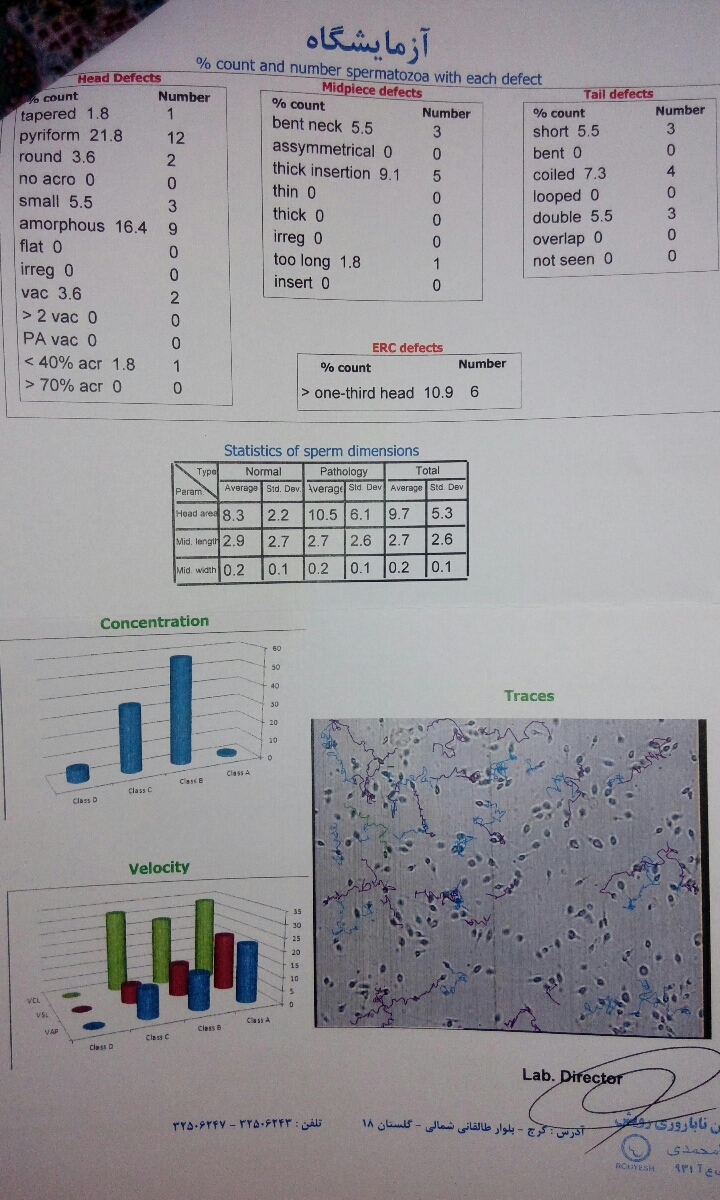جواب آزمایش اسپرم همسرم