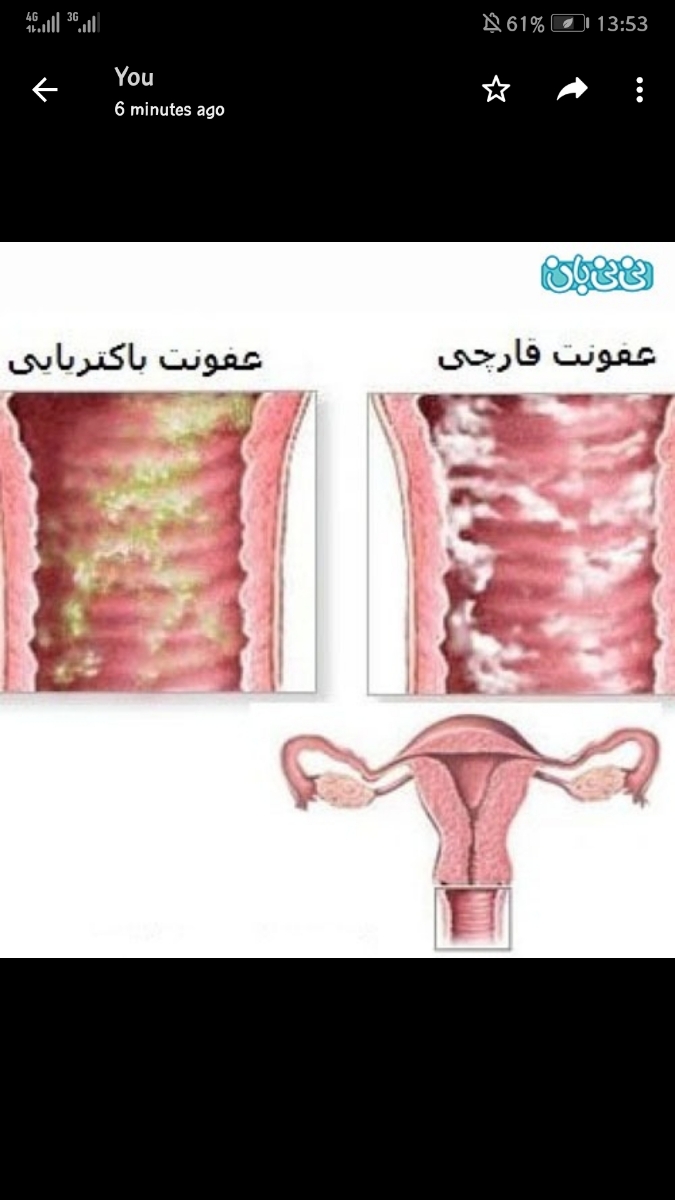 خارش و سوزش واژن