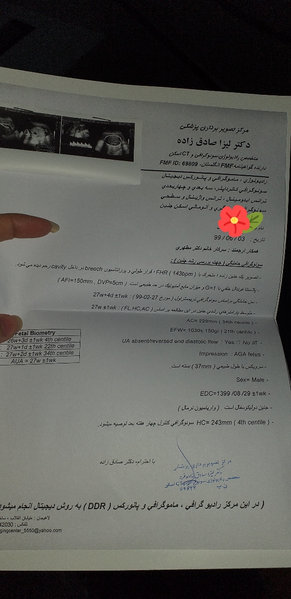 تفسیر سونو وضع جنین در ۲۸ هفتگی