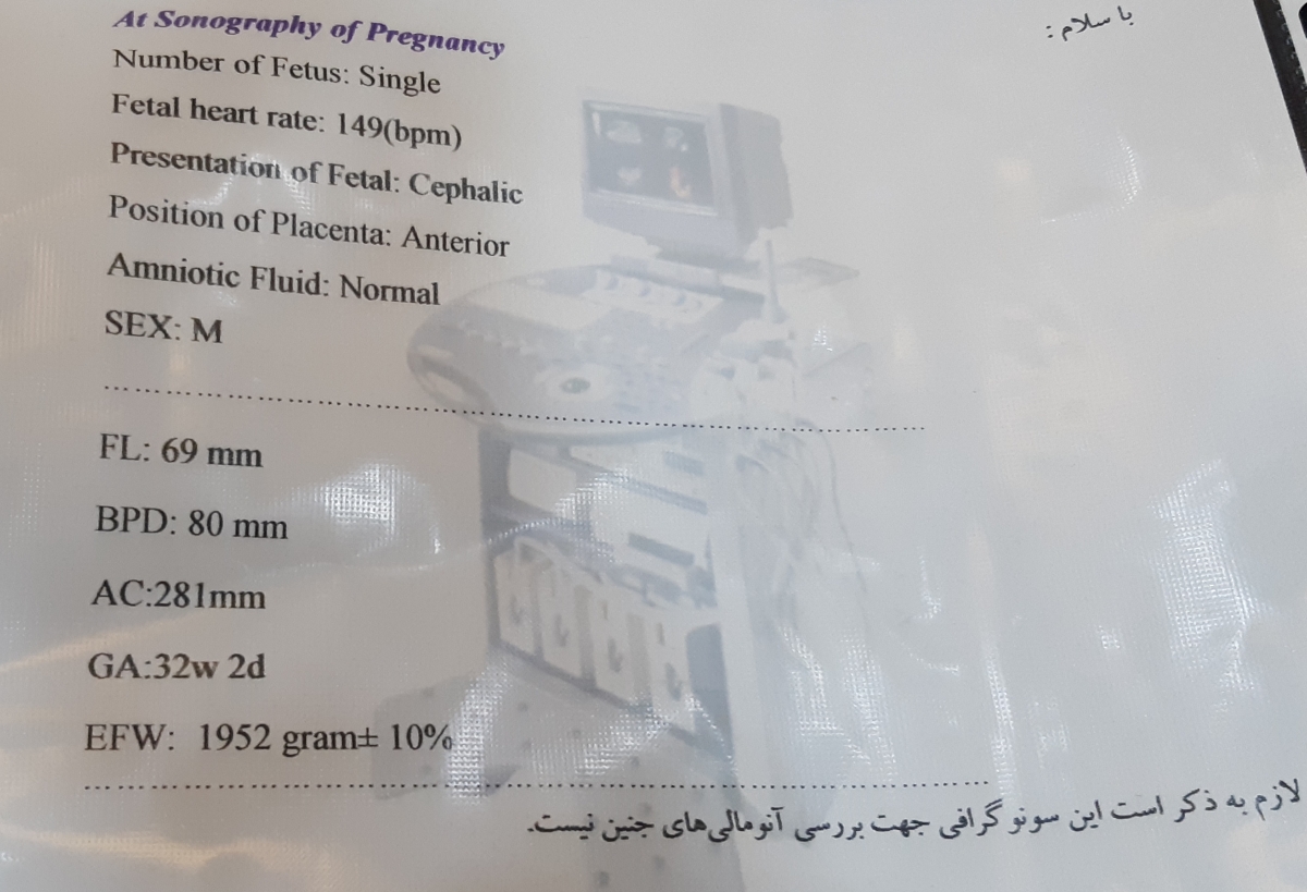 جواب سونوگرافیم چطوره.خیلی نگرانم